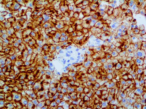 IHC of CD75 on an FFPE Liver Tissue